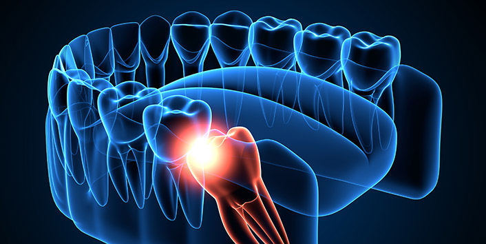 Soft Foods Guidelines San Luis Obispo CA, San Luis Oral Surgery